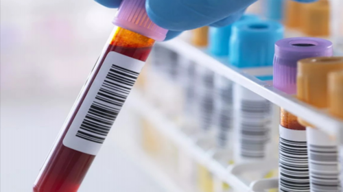 <strong>重庆供卵代生妈妈和孩子 重庆三代试管男孩费用明细 ‘b超单有一行字看男女’</strong>