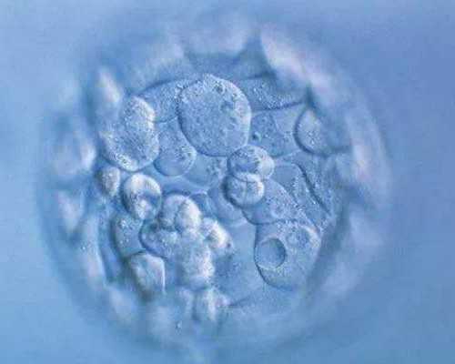 2024重庆代生生小孩费用 重庆治疗多囊卵巢医院如何选择？有什么样选择标准？