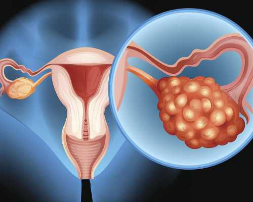 重庆正规助孕包成功价格 重庆市计生医院试管婴儿费用明细 ‘肚型看男女什么