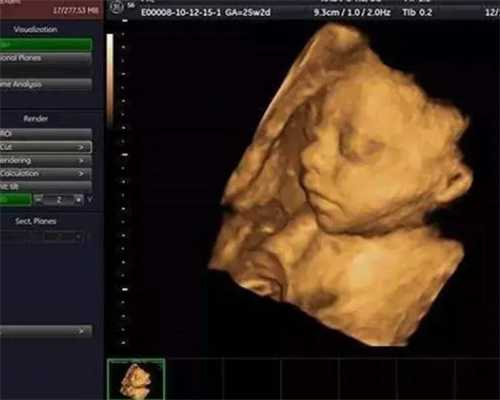 重庆高效供卵试管网 重庆三代试管包生男孩多少费用?生男孩费用十万够吗? ‘