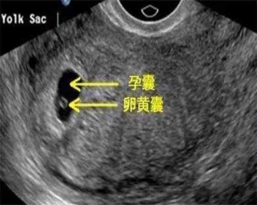 温州有代怀生男孩 温州附一医院做试管费用 ‘怀孕哪些症状可以看出男女’