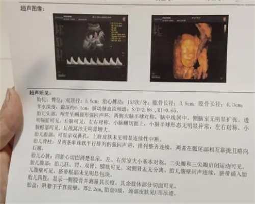 重庆助孕套餐中介 2024年重庆七星岗妇幼做试管大概要多少钱? ‘孕囊3.7*3.9*3.