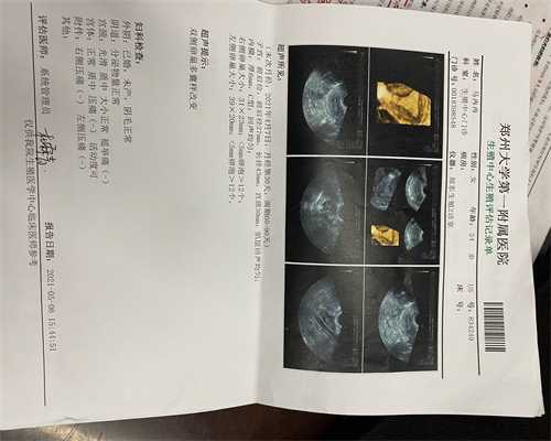 重庆供卵好不好 重庆西南医院三代试管怎么样？三代试管成功率高吗？ ‘32周