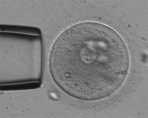 重庆代生孩子资源 重庆不孕不育医院推荐： ‘32周双顶径看男女’