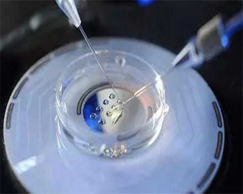 重庆代生宝宝免费咨询 1重庆私立供卵机构25万不用等卵源，还能包成功?可信度