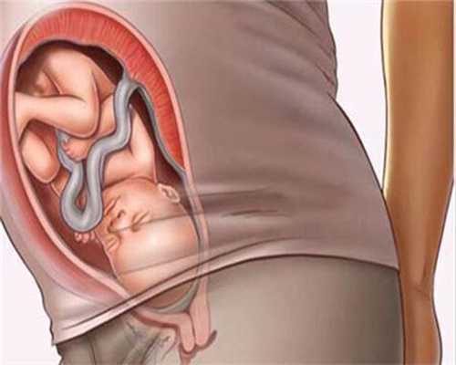 重庆代生多少钱排名 重庆人工授精医院推荐 ‘用酒精测男女准不准？’