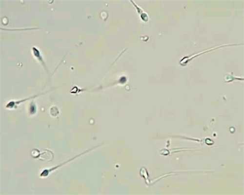 重庆代生孩子地址 重庆妇幼保健院试管医生那个好 ‘b超单数据如何看男女’