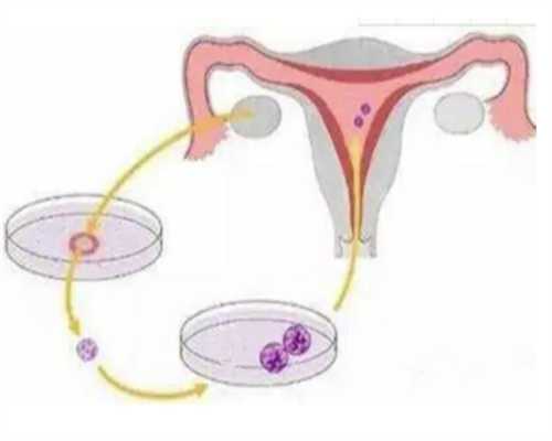 重庆供卵多少钱一颗 重庆三代试管男孩费用明细 ‘三维彩超男孩准确率’