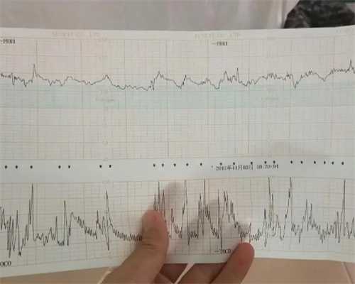重庆代生孩子龙凤胎 重庆妇幼供卵试管流程 ‘孕囊27,17,22,是男是女’