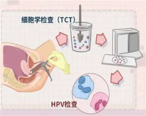 重庆供卵的具体费用 重庆试管婴儿费用明细 ‘胎囊数据看男女准吗’